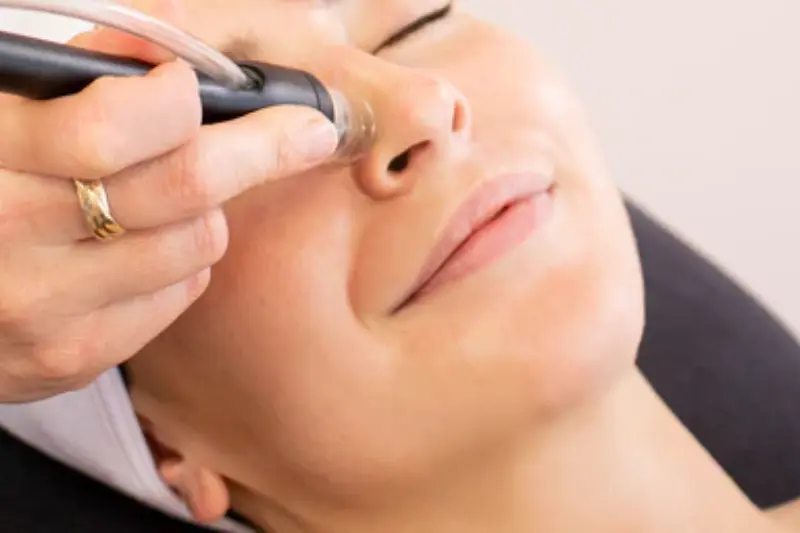 Beauty Tips for Black Spots